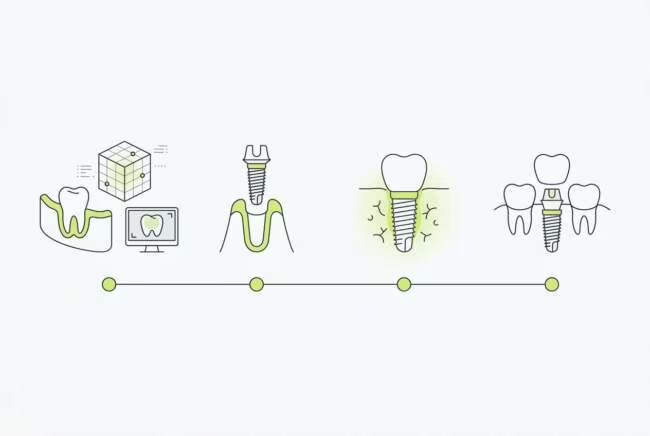 как проходит имплантация зубов этапы и сроки