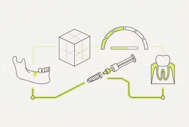 как проходит имплантация зубов москва: этапы и сроки