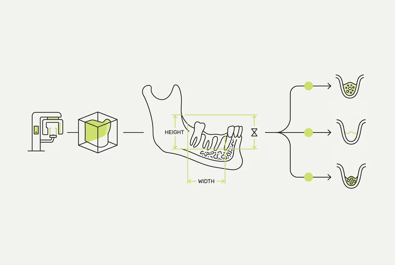Схема диагностики для костной пластики